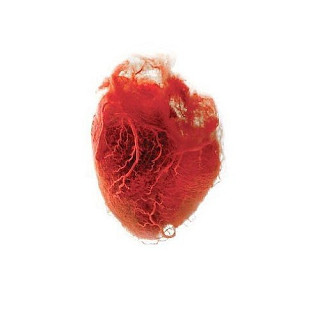 Akron/Family - Love Is Simple